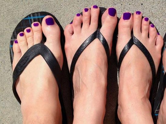 Purple toenails